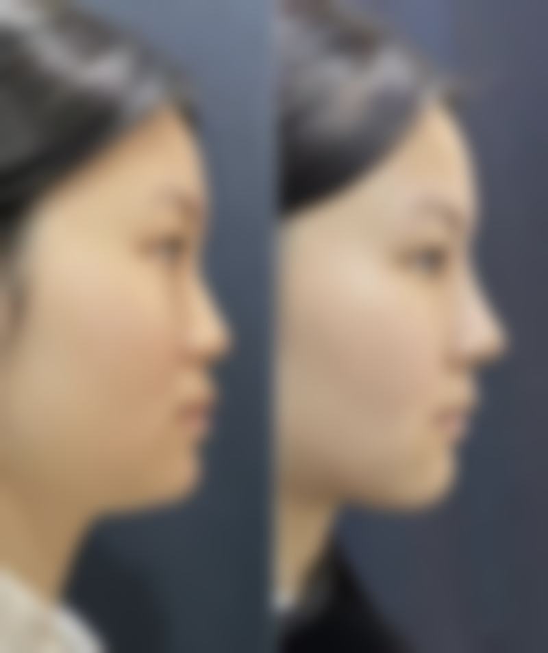 【郑州汇颜医疗美容医院是正规的吗?】