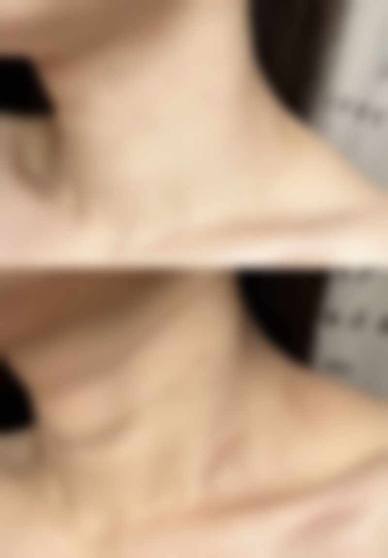 【济宁华悦整形医院患者口碑评价：】