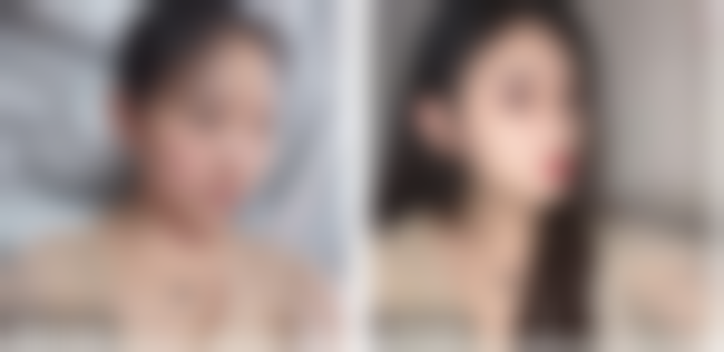 【谢占军 医生擅长项目】