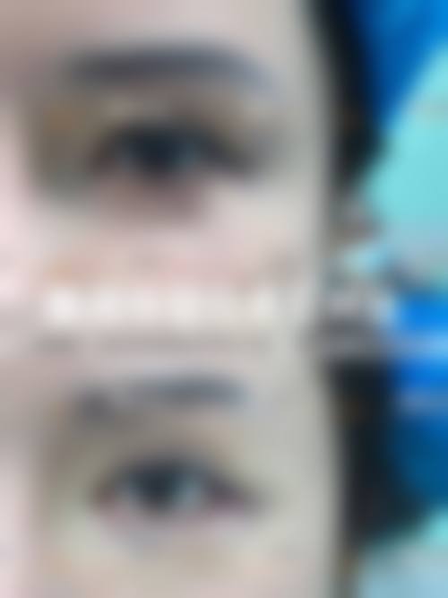 【河南开封爱丽莎医疗美容门诊地址：】