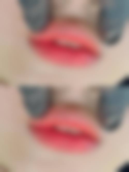 【郑州碧莲盛植发整容医院诊疗设备:】