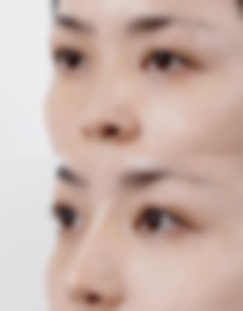 【沈阳润然医疗美容门诊部怎么预约挂号?】