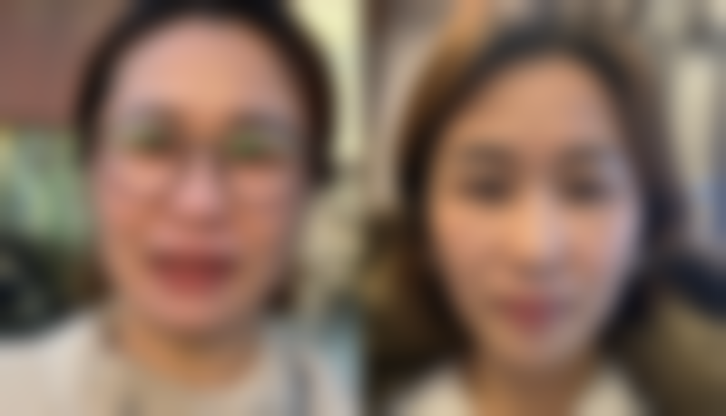 【苏州华美美容医院特色项目:】