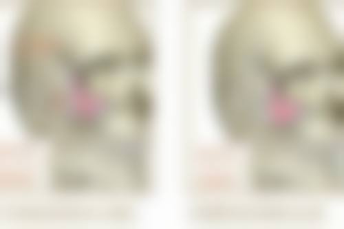 正畸可以改变脸歪吗