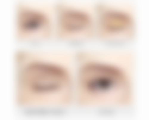 牙性或轻度骨性错合畸形的矫治目的