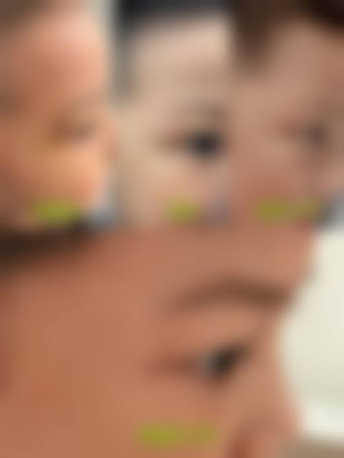 【龙泉驿区第一人民医院整形美容科诊疗设备：】