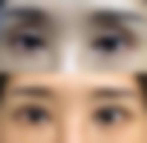 【郑桂龙医生擅长项目：】