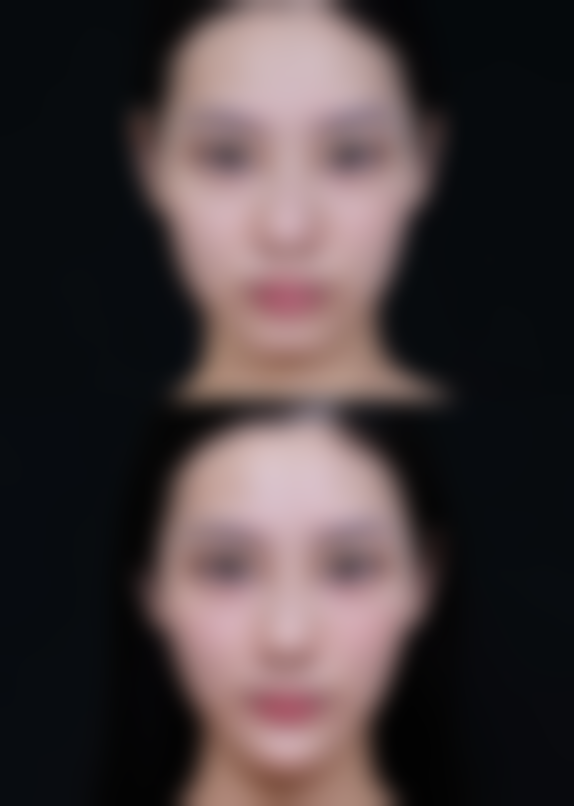 【江西中医和西医结合医院整形美容科特色项目:】