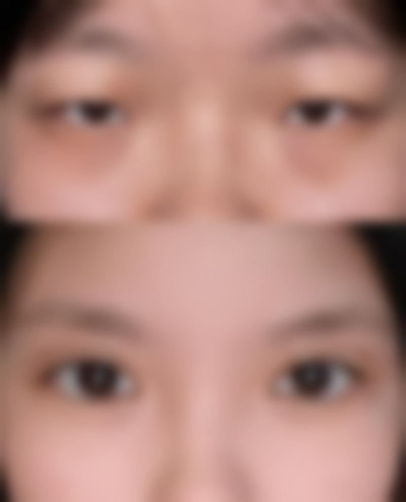 虽然没有详细描述医院的环境,但从医院的使命和服务理念可以想象,医院会努力营造一个舒适、温馨的环境。舒适的环境能够让顾客在接受医美服务的过程中更加放松,减轻紧张和焦虑的情绪。医院可能会有宽敞明亮的接待区、干净整洁的手术室、舒适的休息区等,为顾客提供全方面的优质体验。