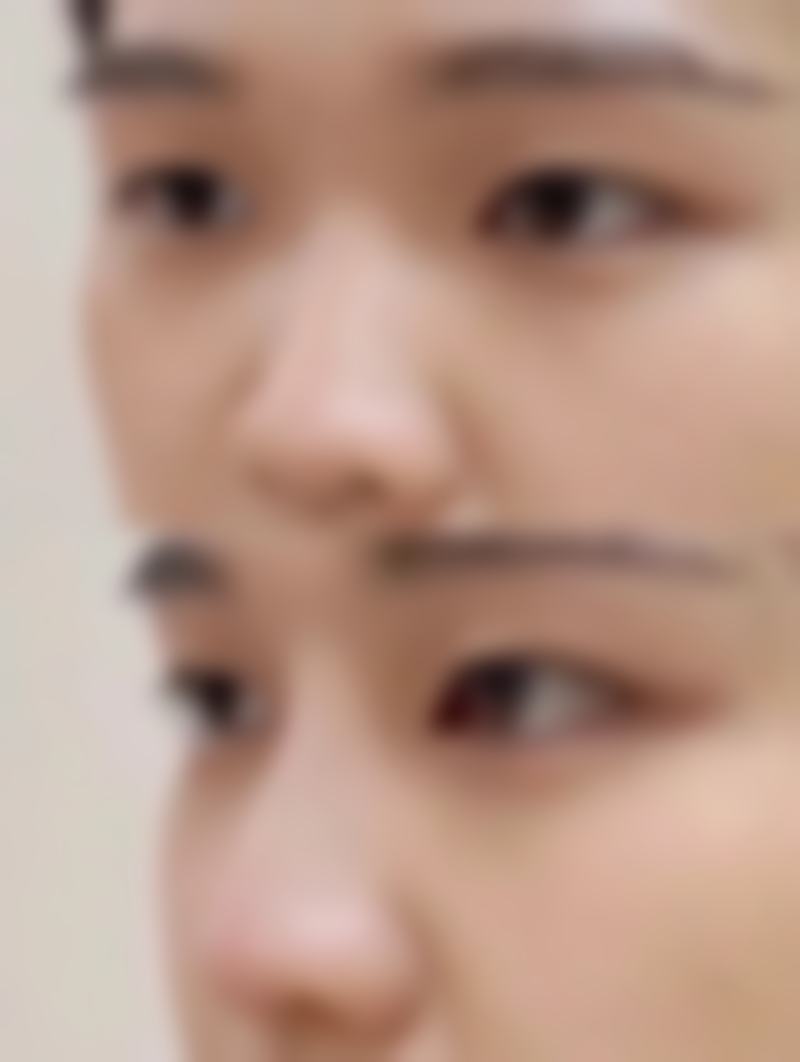 【龙泉驿区第一人民医院整形美容科患者口碑评价：】