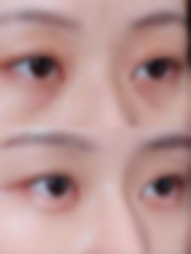 【南通沁慕整形医院诊疗设备：】