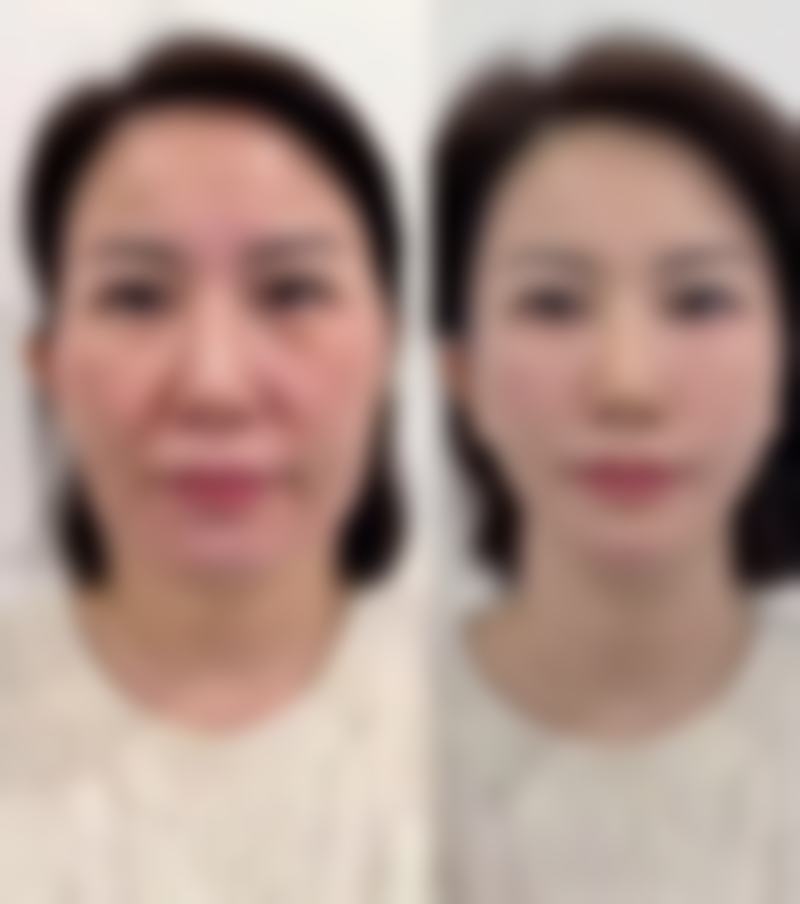 【罗志勇医生口碑怎么样?】