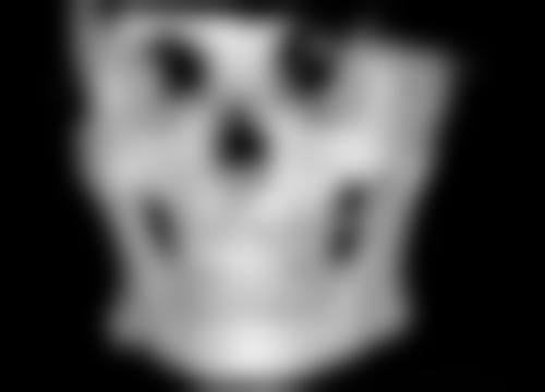 瘦脸针可以维持多久