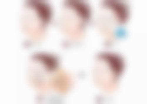 生完孩子可以做阴缩吗