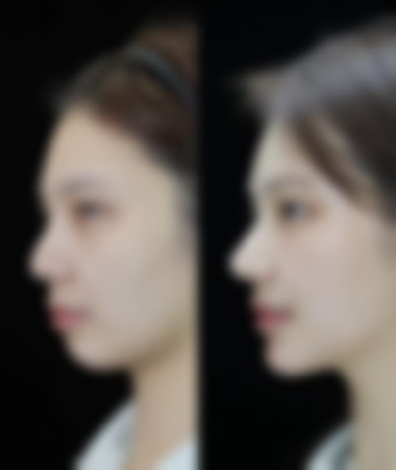 【南通柒颜整形医院核心优势：】