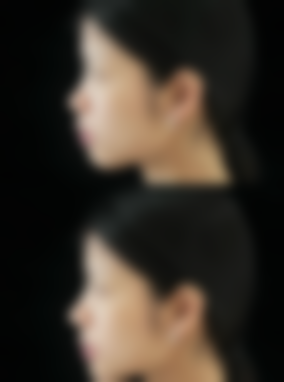 【南通柒颜整形医院诊疗设备：】