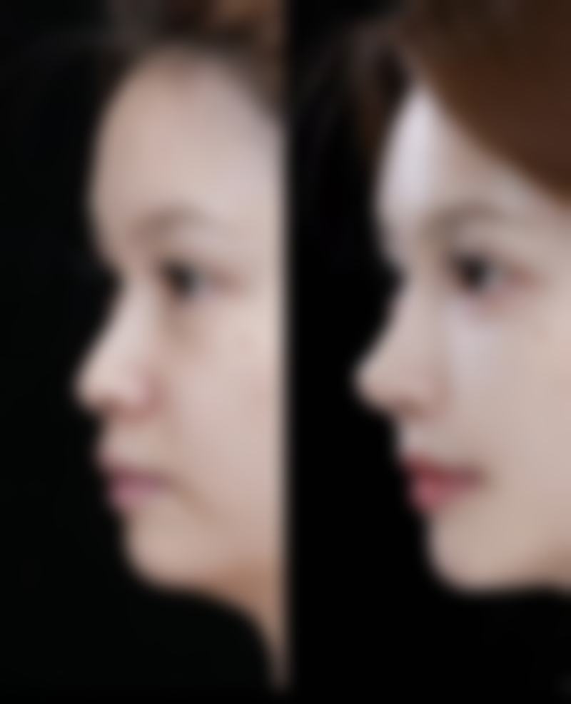 【广东药学院附属医院激光整形美容中 心地址：】