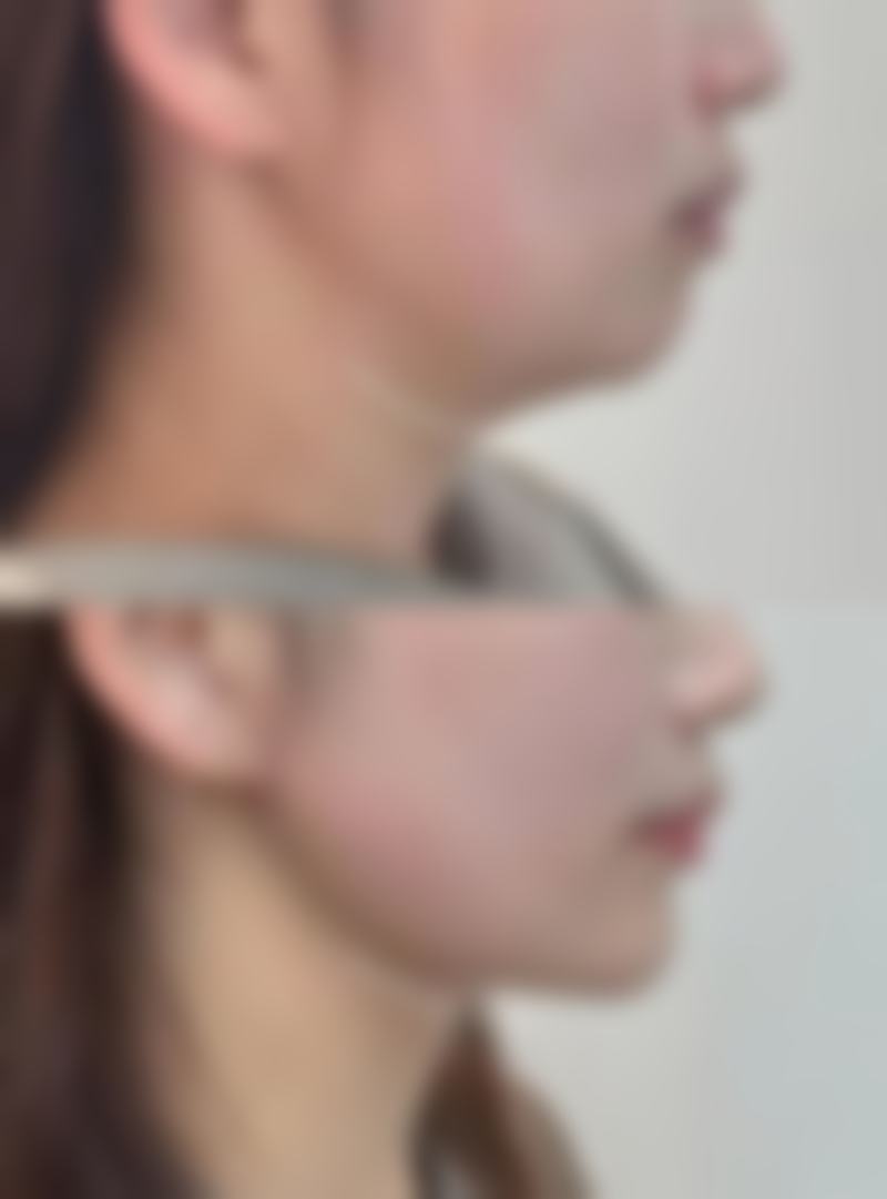 喷雾除皱成效怎么样知乎