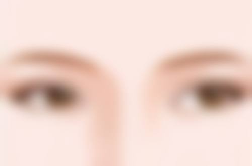 玻尿酸除皱的好处