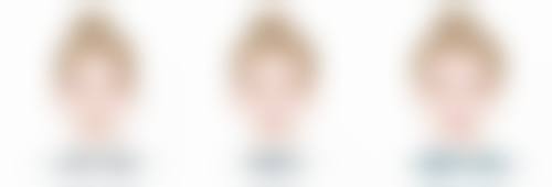 瘦脸针一般打 50 单位还是 100 单位