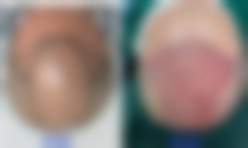 【杭州清吟整形美容医院患者口碑评价：】