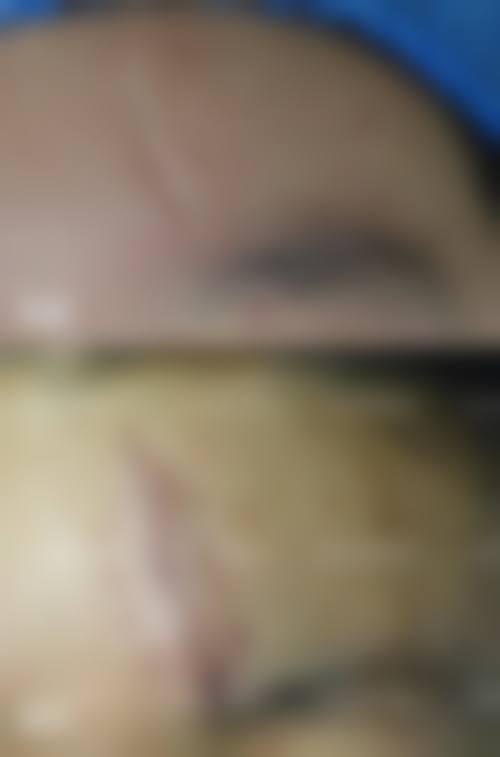 【杭州东方整形医院怎么预约挂号?】