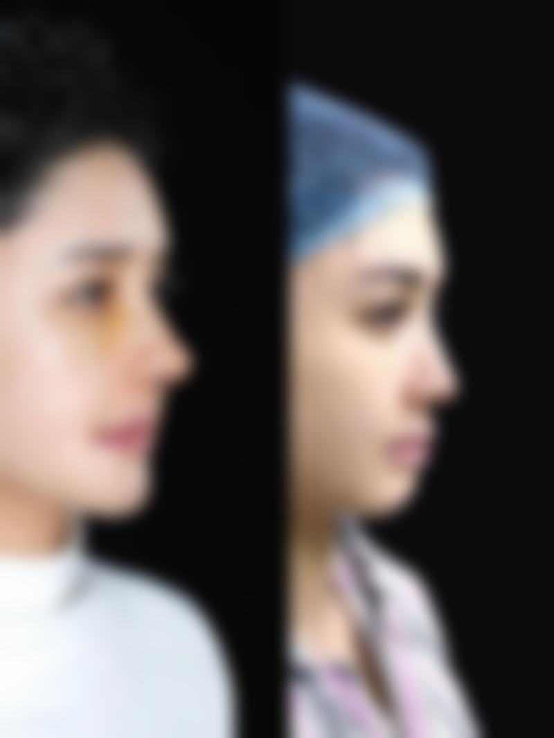 【安徽医 科 大学附属阜阳医院烧伤整形创面外科参考价格表：】