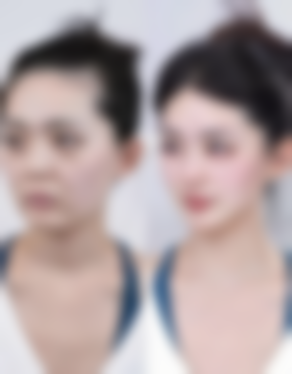 【张建军 医生擅长项目】