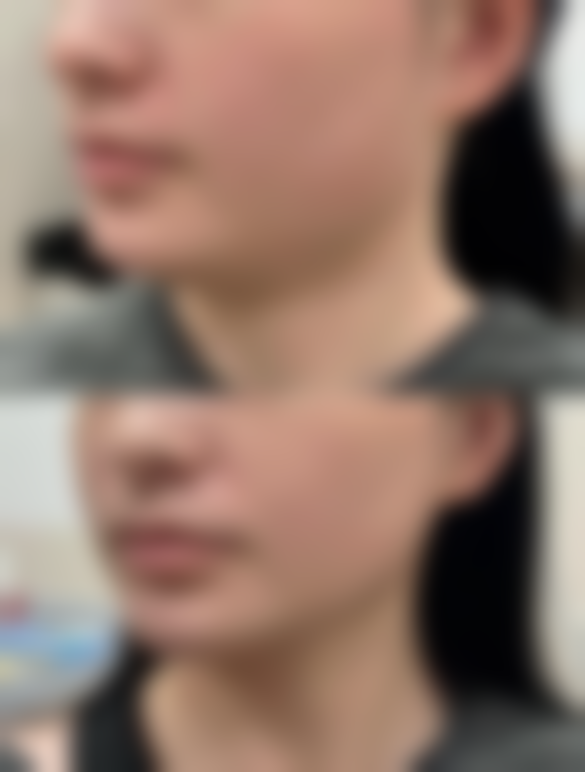 【张建军 医生技术特点】