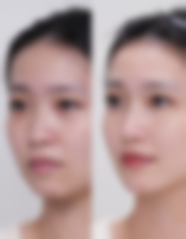 口服玻尿酸：真的能补水吗？