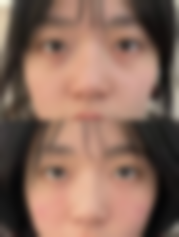 瘦脸针哪里打比较正规