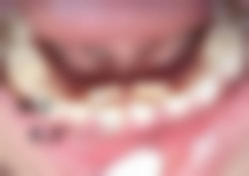 头发是不是可以种植