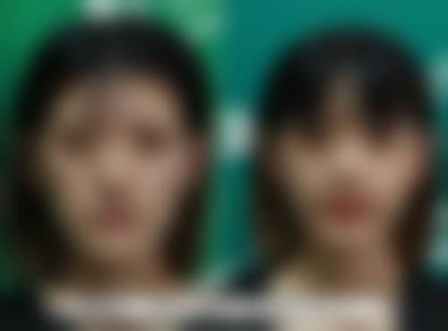 瘦脸针一般打 50 单位还是 100 单位