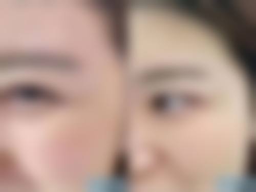 给想要植发的人的建议