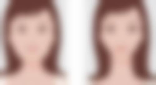 瘦脸针打完多久见效