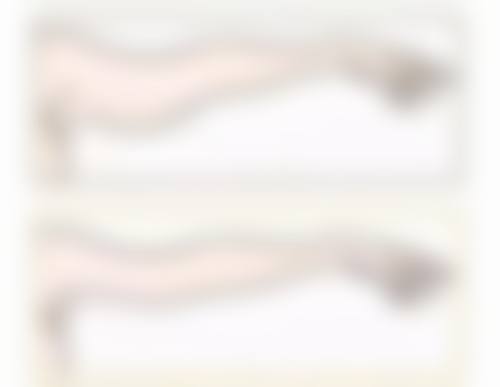 瘦脸针消失后会跟原来一样嘛