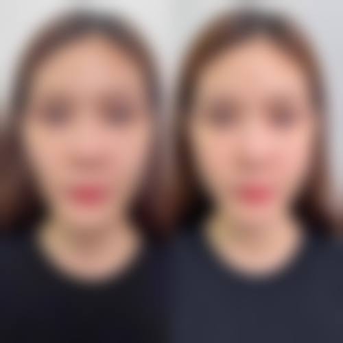 目前虽然没有具体的医生名字信息，但可以知道医院是以乳腺专精人才和精良技术为核心的。这些医生应该都具备丰富的临床经验和专精知识，在乳腺疾病诊疗和乳房整形美容等方面有着较高的造诣。他们会根据患者的具体情况，制定个性化的治疗方案，确保患者能够得到更适合自己的治疗。