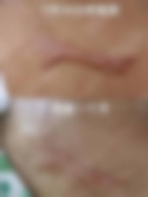 【侯三亭医生擅长项目】