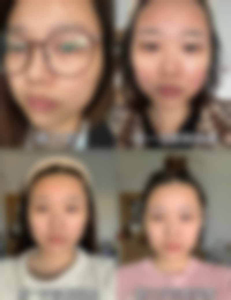 齐鲁医院青岛院区整形美容科靠不靠谱？