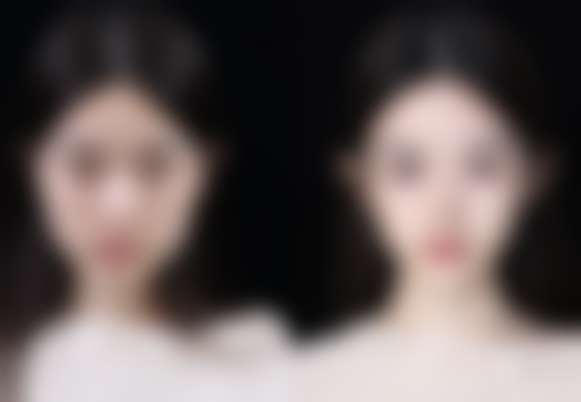 【陈立杰（台）医生技术特点】