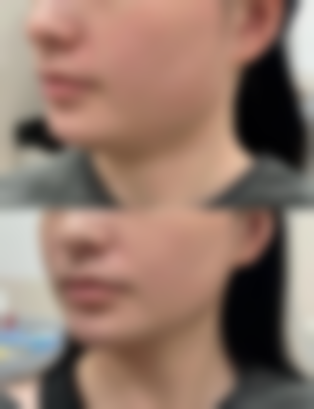 【青岛刘晋胜医疗美容怎么预约挂号?】