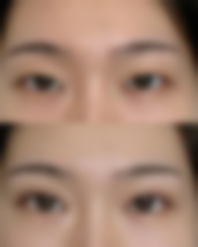 【衡阳摩姿医疗美容门诊部参考价格表：】