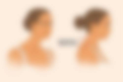 自体脂肪填充的副作用和危害