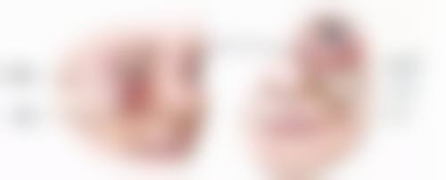 阴道紧缩术多少钱？