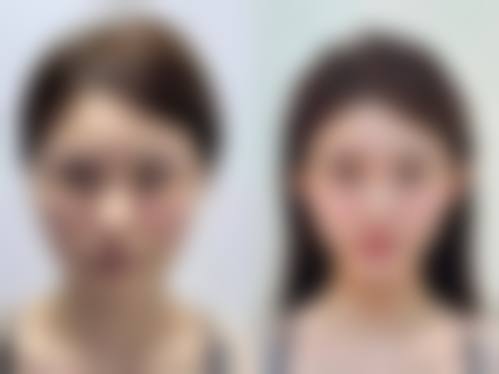 【临沂市中医院整形美容中 心怎么预约挂号?】