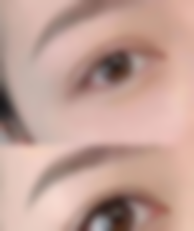 阴道紧缩术费用的大致范围