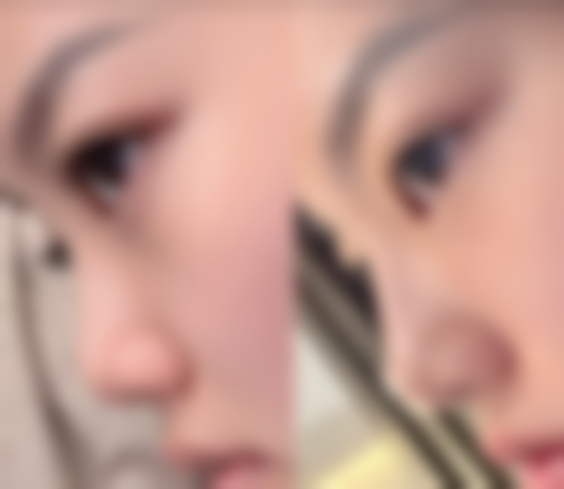 【临沂市中医院整形美容中 心患者口碑评价：】