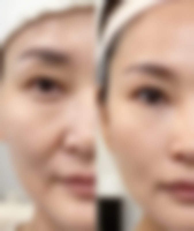 广汉美丽部落医疗美容诊所是一家正规的民营医美机构。它隶属于美丽部落医美连锁，有着规范的运营和管理体系。在医资方面，拥有专精的医护团队；设备上配备了精良的医疗设备；技术和服务也都遵循着严格的标准，在多方面与国内外接轨，所以大家可以放心选择。