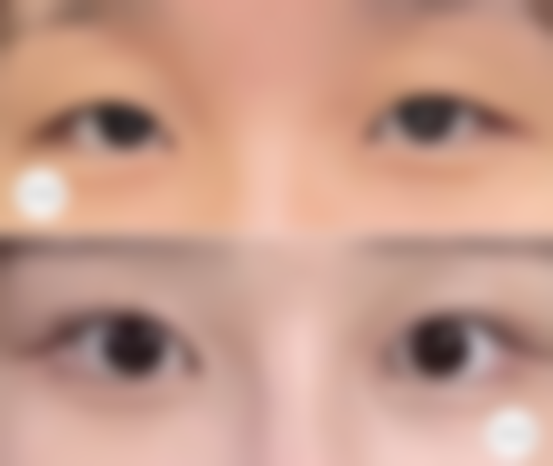 【临沂市中医院整形美容中 心诊疗设备：】