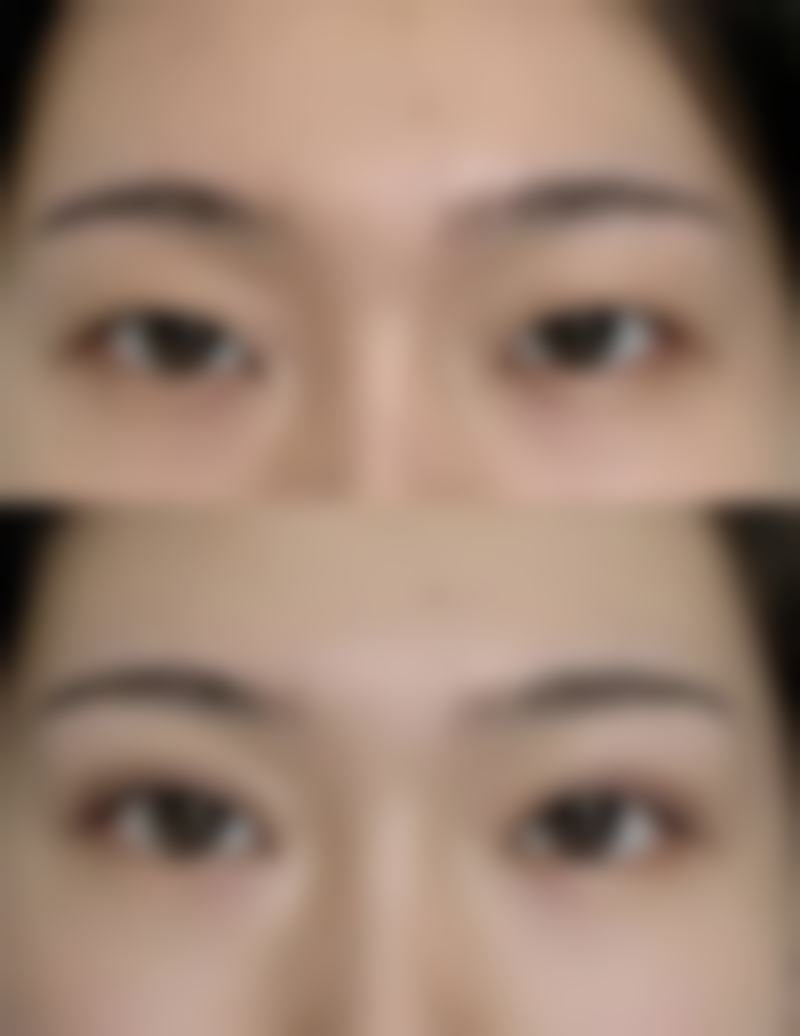 【徐辅翊医生擅长项目：】